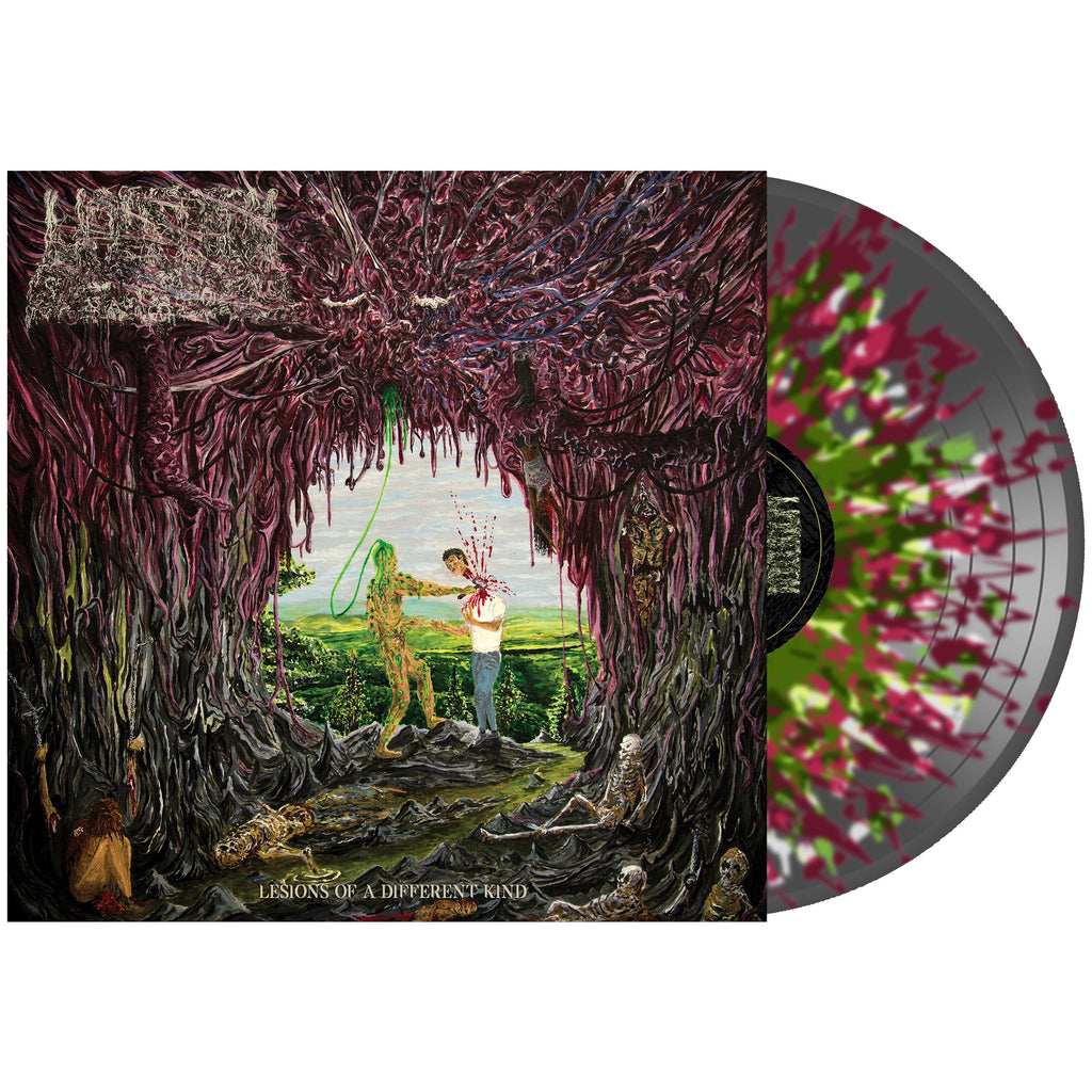 UNDEATH 'LESIONS OF A DIFFERENT KIND' LP (Multiple Color Variant Vinyl)